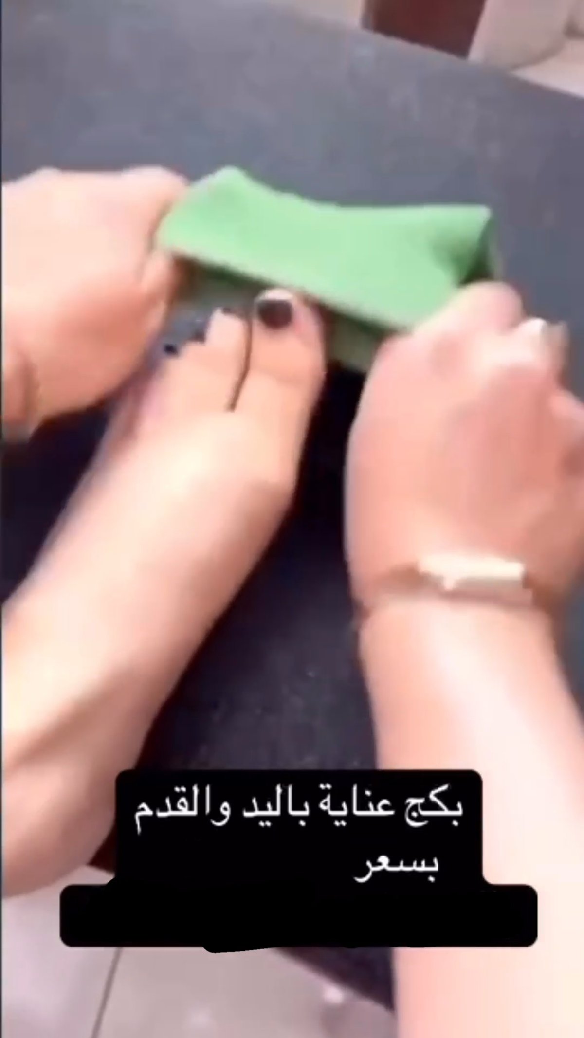 كريم علاج تشقق الكعبين مع جوارب سيليكون - 6